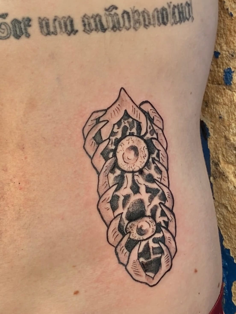 Large perforated bone mass along the ribs