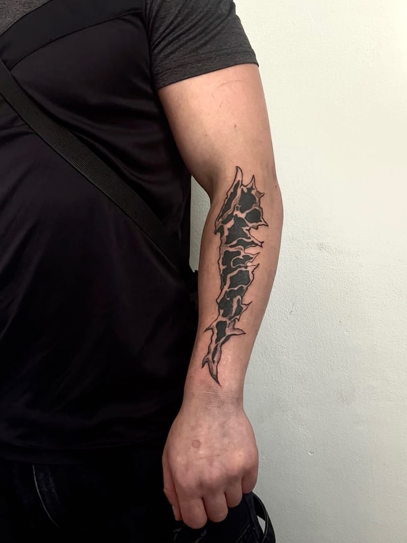 Exoskeletal bone mass along the forearm, healed, outdoors